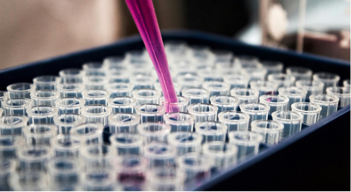 Excellence funds, excellent outcomes? Insights from Italy’s higher education policy