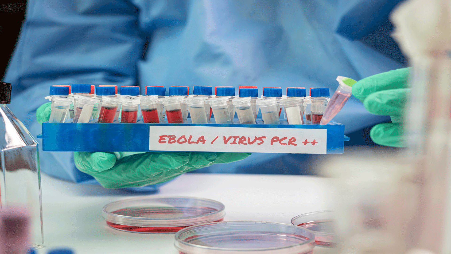 Hands of scientist holding PCR test for Ebola virus